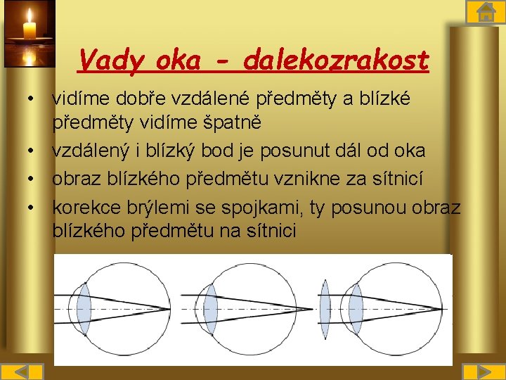 Vady oka - dalekozrakost • vidíme dobře vzdálené předměty a blízké předměty vidíme špatně