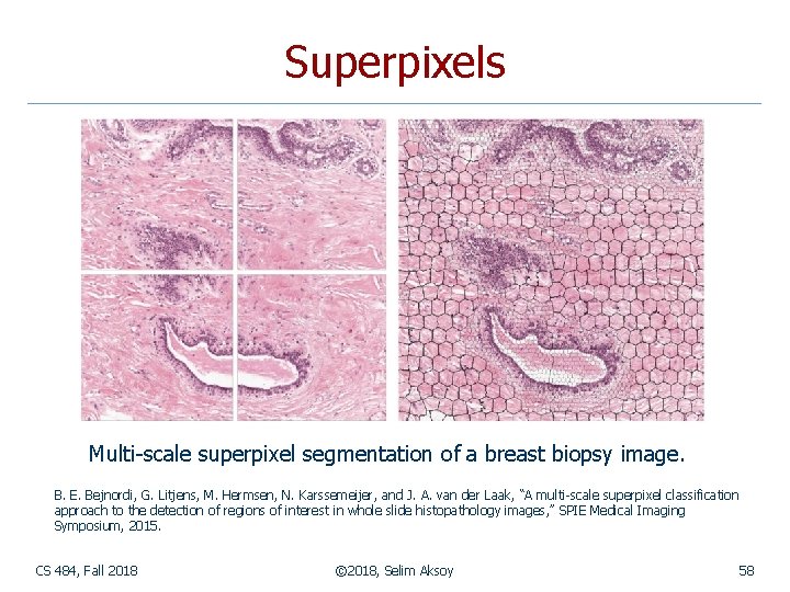 Superpixels Multi-scale superpixel segmentation of a breast biopsy image. B. E. Bejnordi, G. Litjens,