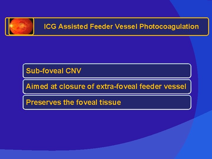 ICG Assisted Feeder Vessel Photocoagulation Sub-foveal CNV Aimed at closure of extra-foveal feeder vessel