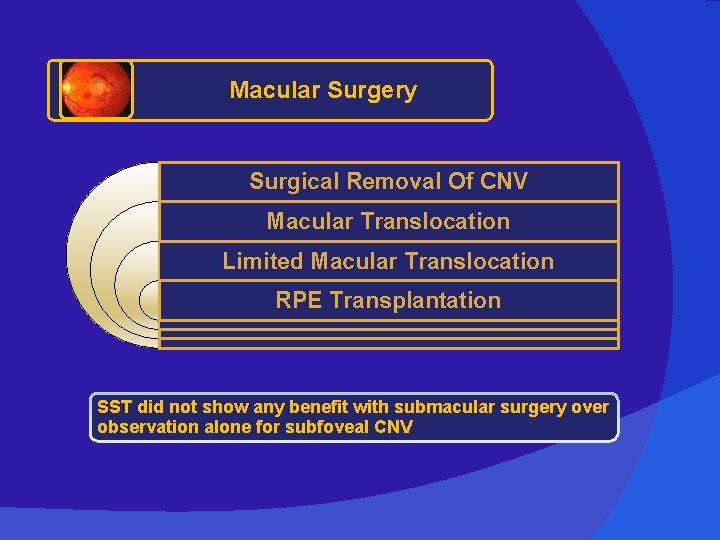 Macular Surgery Surgical Removal Of CNV Macular Translocation Limited Macular Translocation RPE Transplantation SST