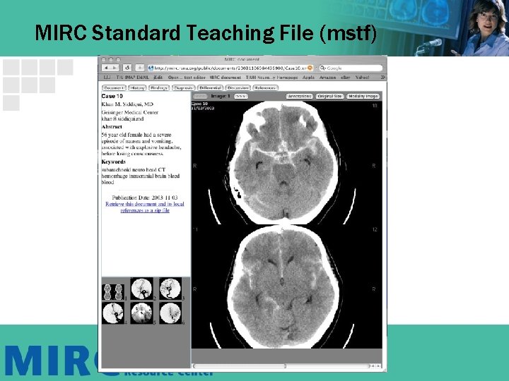 MIRC Standard Teaching File (mstf) MIRC Standard Teaching File (mstf)