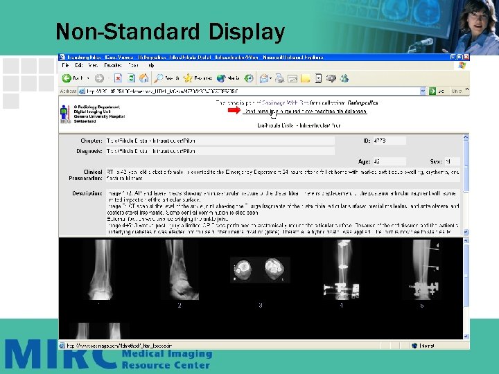 Non-Standard Display Non-Standard Display