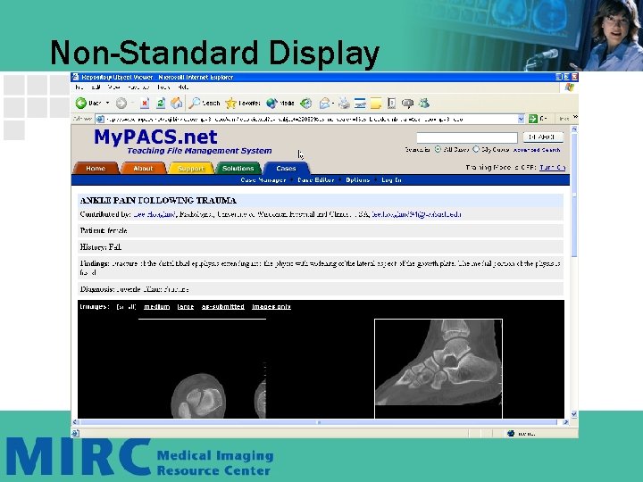 Non-Standard Display Non-Standard Display