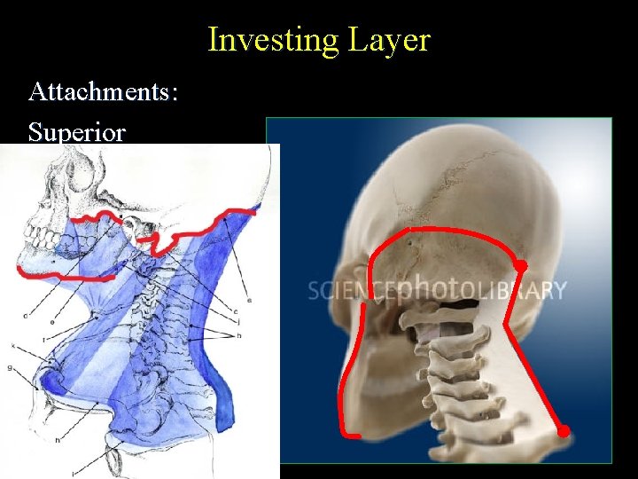 Investing Layer Attachments: Superior 