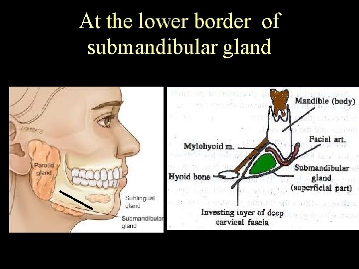 At the lower border of submandibular gland 