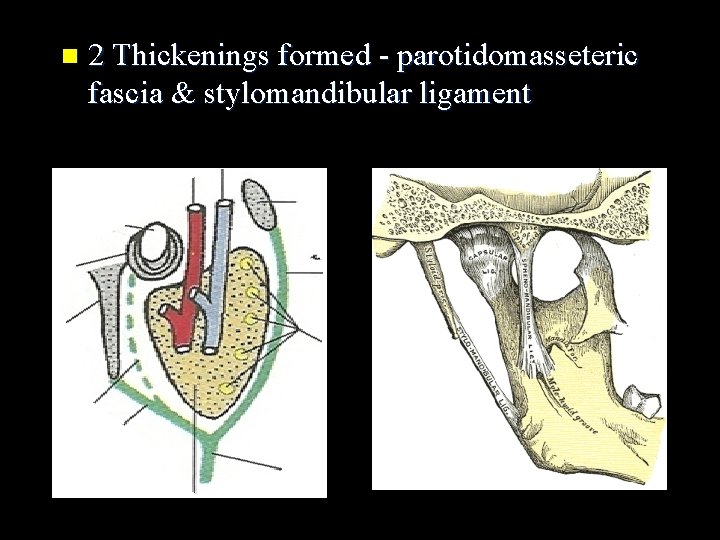 n 2 Thickenings formed - parotidomasseteric fascia & stylomandibular ligament 