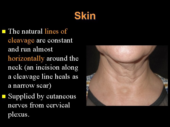 Skin The natural lines of cleavage are constant and run almost horizontally around the