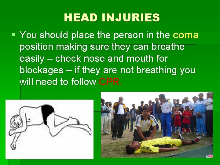 HEAD INJURIES § You should place the person in the coma position making sure
