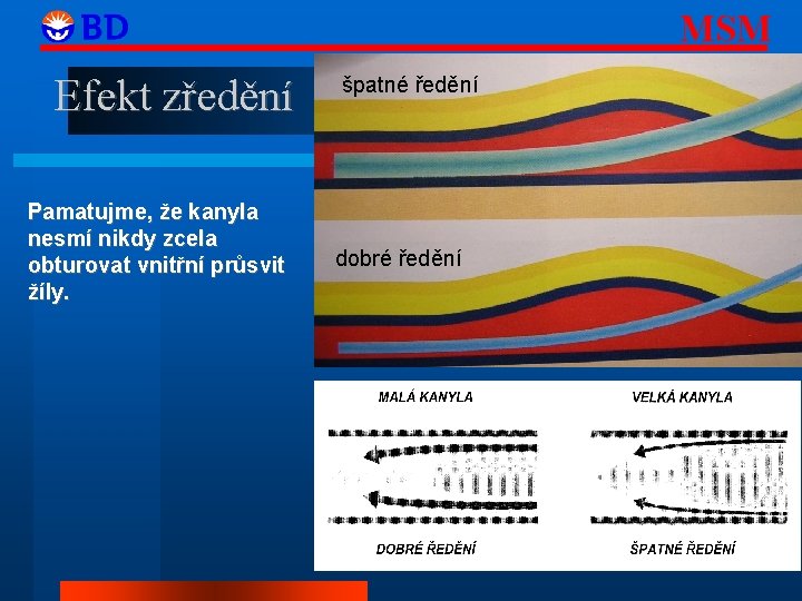 MSM Efekt zředění Pamatujme, že kanyla nesmí nikdy zcela obturovat vnitřní průsvit žíly. špatné