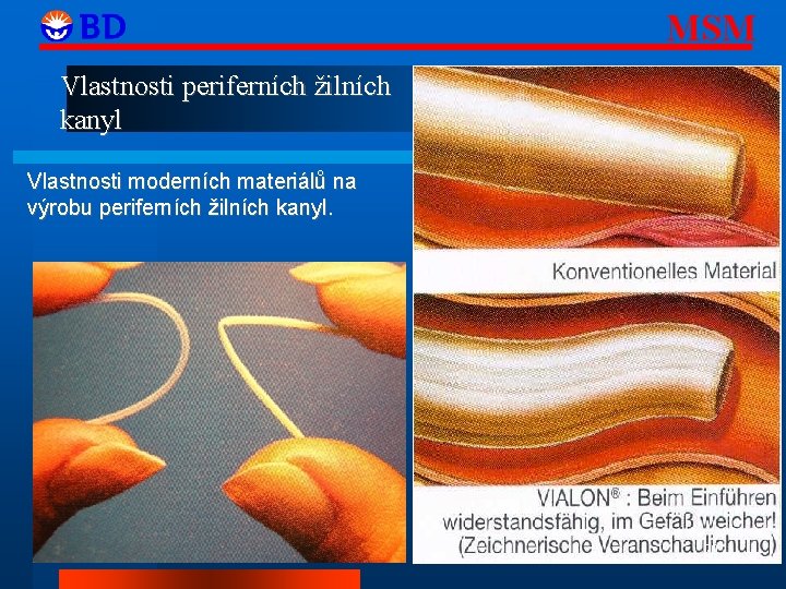 MSM Vlastnosti periferních žilních kanyl Vlastnosti moderních materiálů na výrobu periferních žilních kanyl. 20