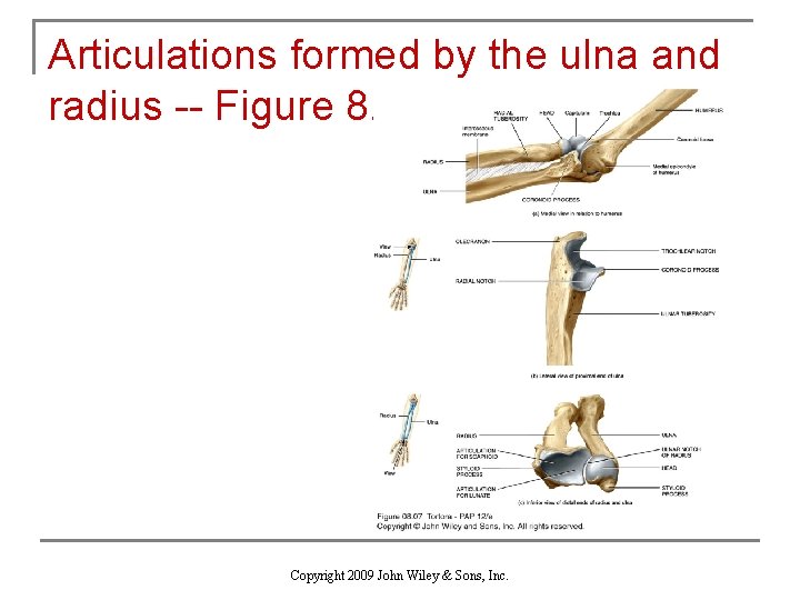 Articulations formed by the ulna and radius -- Figure 8. 7 Copyright 2009 John
