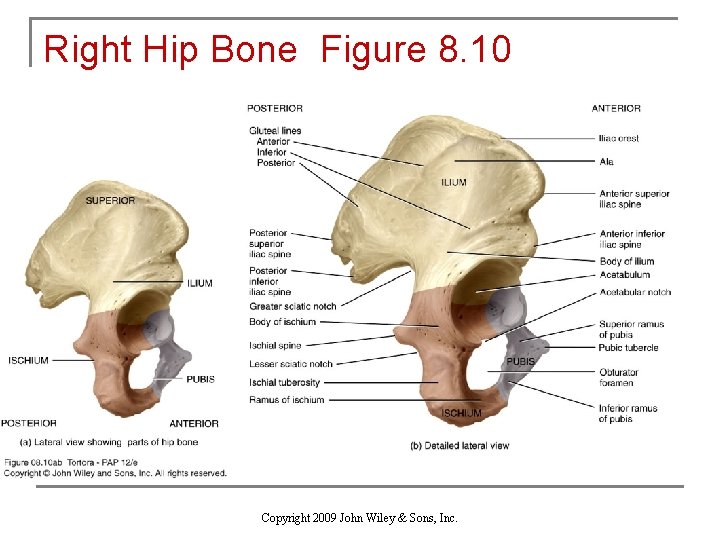 Right Hip Bone Figure 8. 10 Copyright 2009 John Wiley & Sons, Inc. 