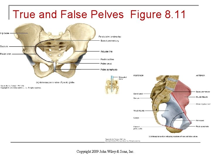 True and False Pelves Figure 8. 11 Copyright 2009 John Wiley & Sons, Inc.