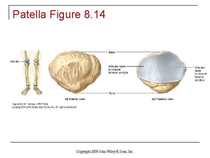 Patella Figure 8. 14 Copyright 2009 John Wiley & Sons, Inc. 