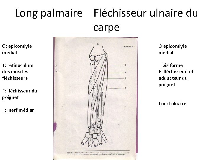 Long palmaire Fléchisseur ulnaire du carpe O: épicondyle médial O épicondyle médial T: rétinaculum