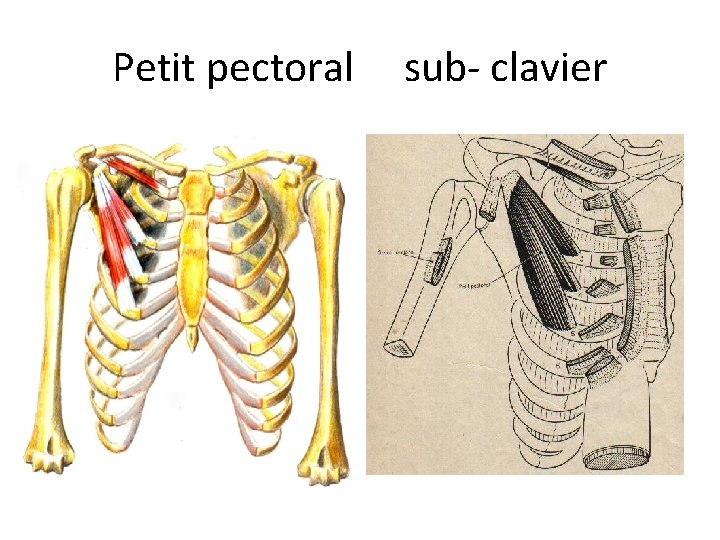 Petit pectoral sub- clavier 