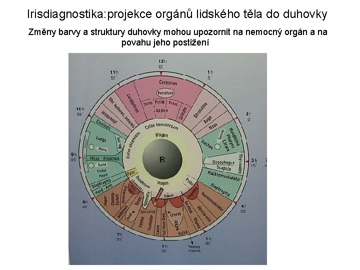  Irisdiagnostika: projekce orgánů lidského těla do duhovky Změny barvy a struktury duhovky mohou