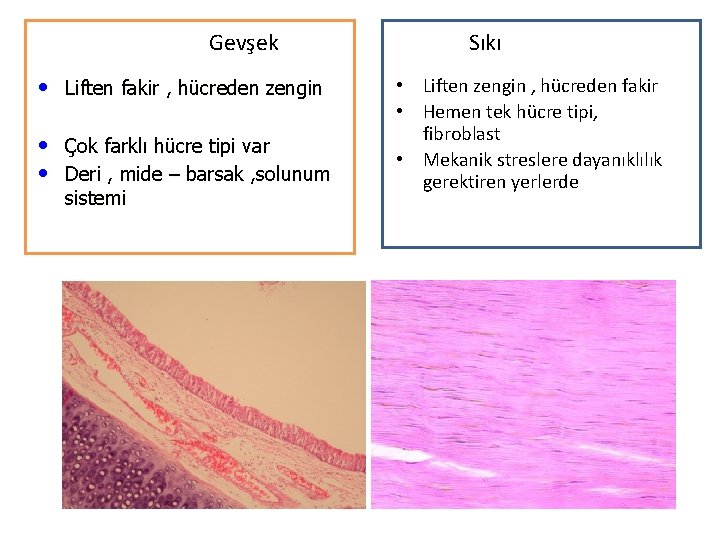 Gevşek • Liften fakir , hücreden zengin • Çok farklı hücre tipi var •