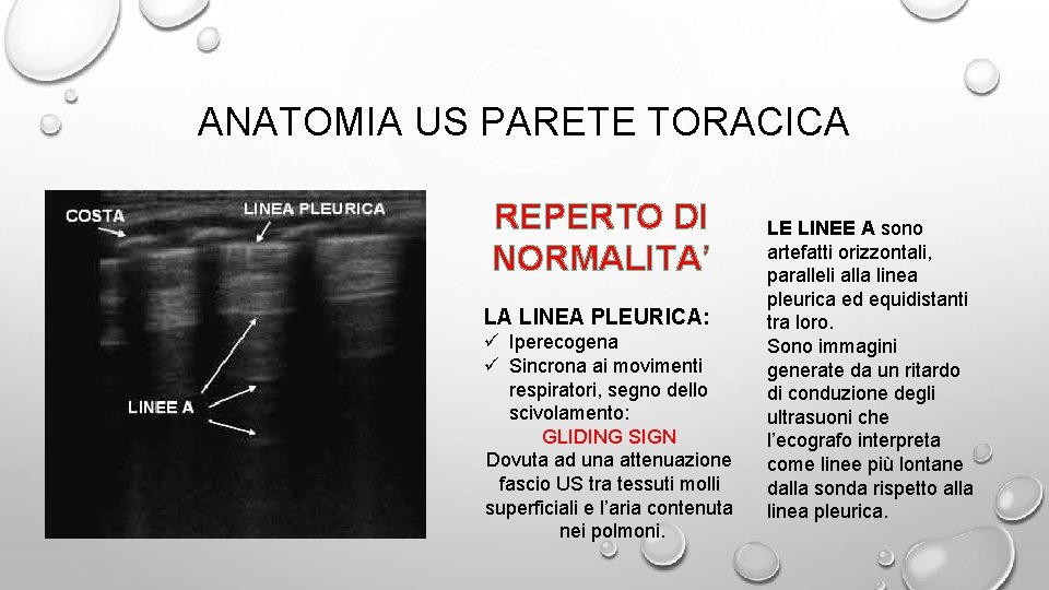 ANATOMIA US PARETE TORACICA REPERTO DI NORMALITA’ LA LINEA PLEURICA: ü Iperecogena ü Sincrona