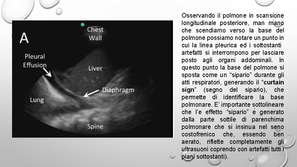 Osservando il polmone in scansione longitudinale posteriore, mano che scendiamo verso la base del