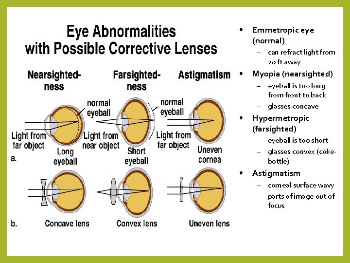  • Emmetropic eye (normal) – can refract light from 20 ft away •