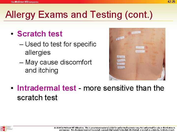 42 -25 Allergy Exams and Testing (cont. ) • Scratch test – Used to