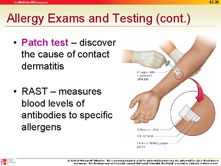 42 -26 Allergy Exams and Testing (cont. ) • Patch test – discover the