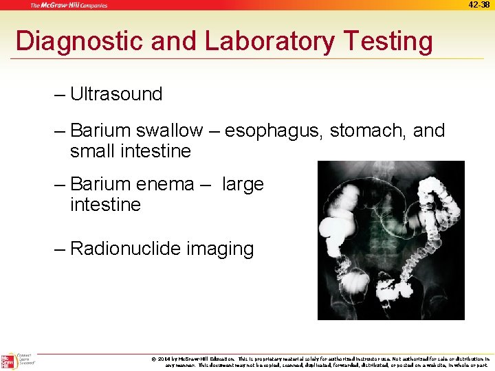 42 -38 Diagnostic and Laboratory Testing – Ultrasound – Barium swallow – esophagus, stomach,