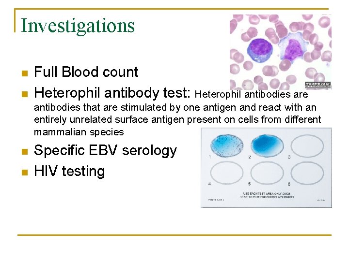 Investigations n n Full Blood count Heterophil antibody test: Heterophil antibodies are antibodies that