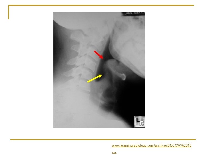 www. learningradiology. com/archives 04/COW%2010 . . . 