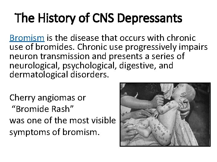 The History of CNS Depressants Bromism is the disease that occurs with chronic use