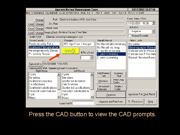 Press the CAD button to view the CAD prompts. 