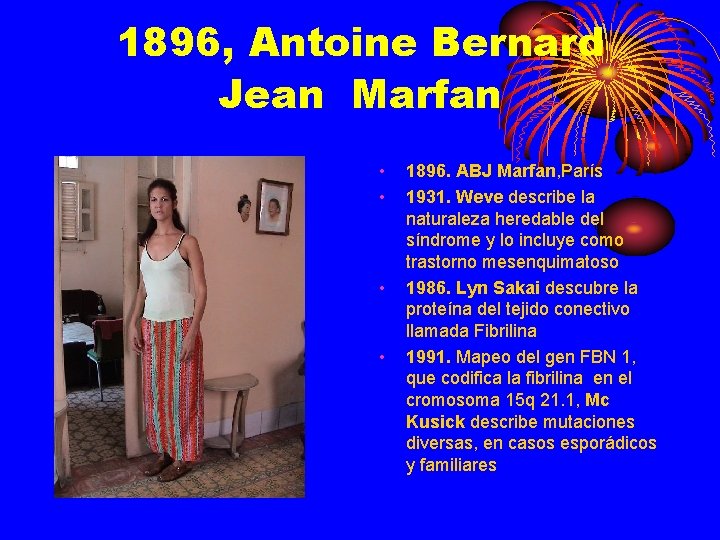 1896, Antoine Bernard Jean Marfan • • 1896. ABJ Marfan, París 1931. Weve describe