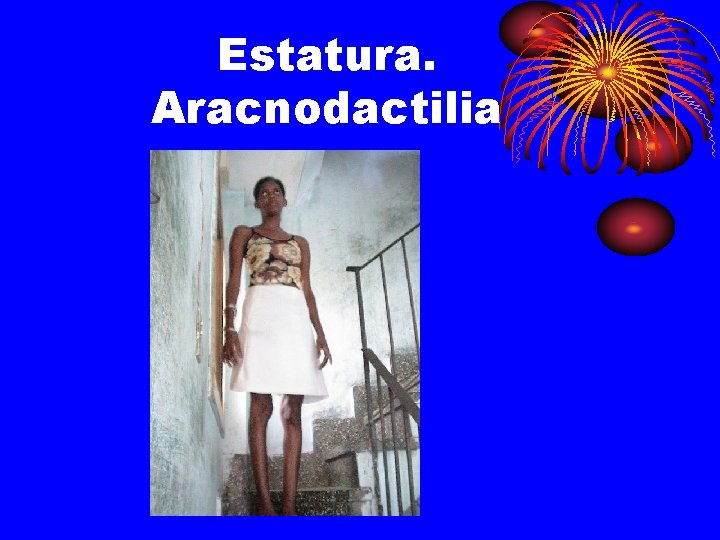 Estatura. Aracnodactilia 