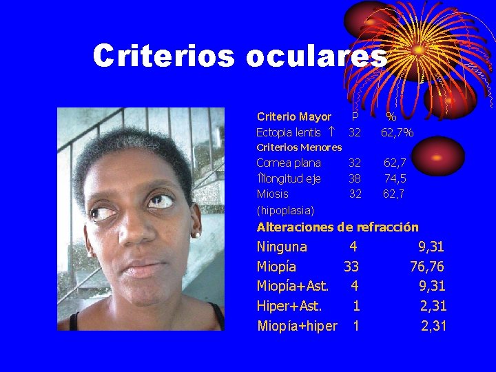 Criterios oculares Criterio Mayor Ectopia lentis P 32 % 62, 7% 32 38 32