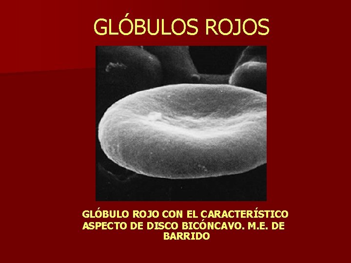 GLÓBULOS ROJOS GLÓBULO ROJO CON EL CARACTERÍSTICO ASPECTO DE DISCO BICÓNCAVO. M. E. DE