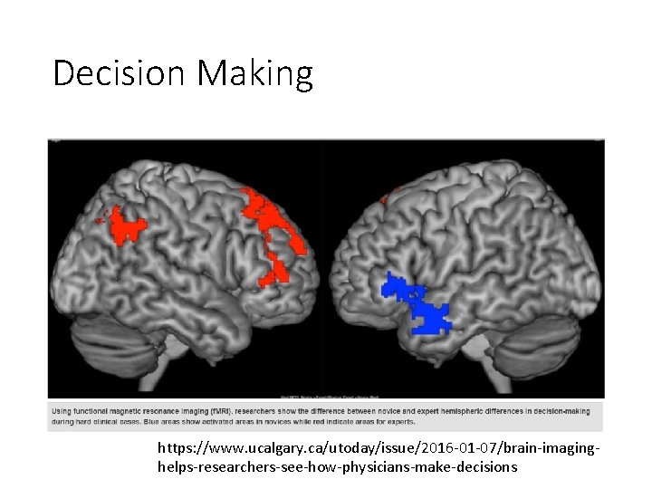 Decision Making https: //www. ucalgary. ca/utoday/issue/2016 -01 -07/brain-imaginghelps-researchers-see-how-physicians-make-decisions 