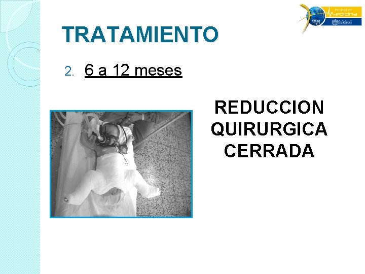 TRATAMIENTO 2. 6 a 12 meses REDUCCION QUIRURGICA CERRADA TRATAMIENTO 2. 6 a 12 meses REDUCCION QUIRURGICA CERRADA