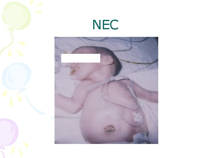 NEC 