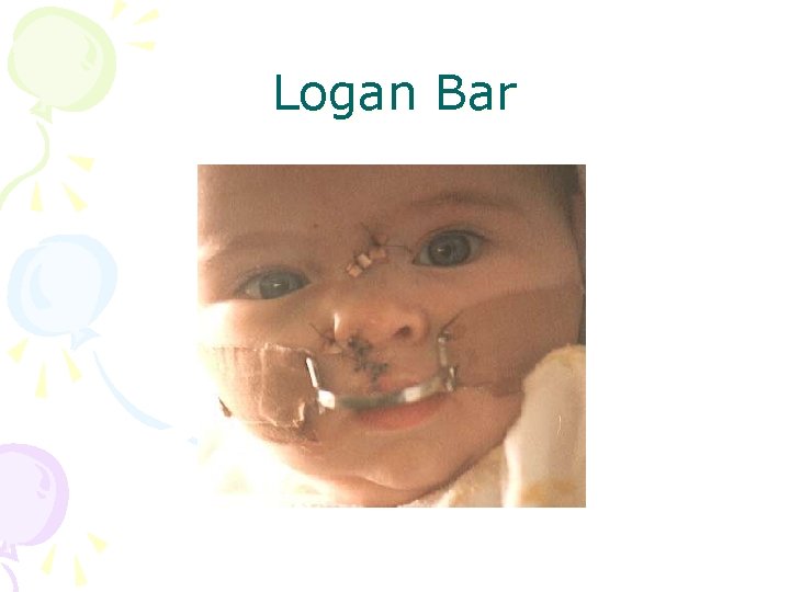 Logan Bar 