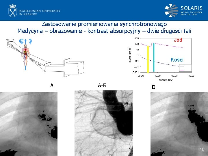 Zastosowanie promieniowania synchrotronowego Naczynia krwionośne Medycyna – obrazowanie - kontrast absorpcyjny – dwie długości