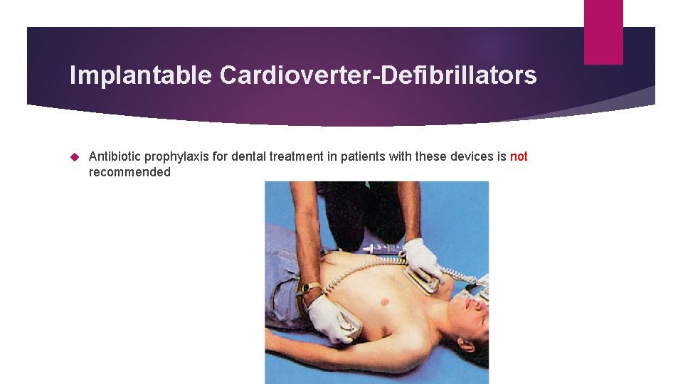 Implantable Cardioverter-Defibrillators Antibiotic prophylaxis for dental treatment in patients with these devices is not Implantable Cardioverter-Defibrillators Antibiotic prophylaxis for dental treatment in patients with these devices is not