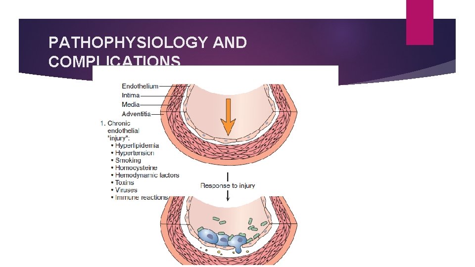 PATHOPHYSIOLOGY AND COMPLICATIONS PATHOPHYSIOLOGY AND COMPLICATIONS