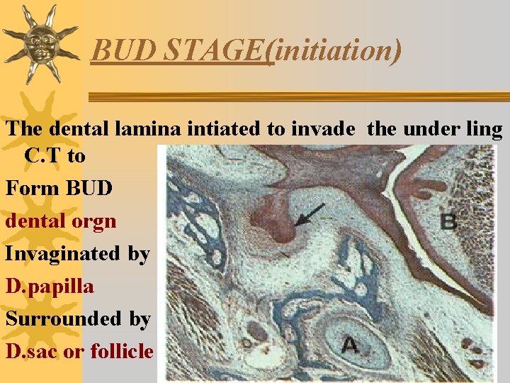 BUD STAGE(initiation) The dental lamina intiated to invade the under ling C. T to