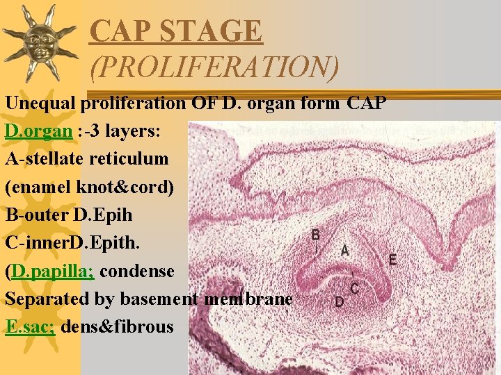 CAP STAGE (PROLIFERATION) Unequal proliferation OF D. organ form CAP D. organ : -3