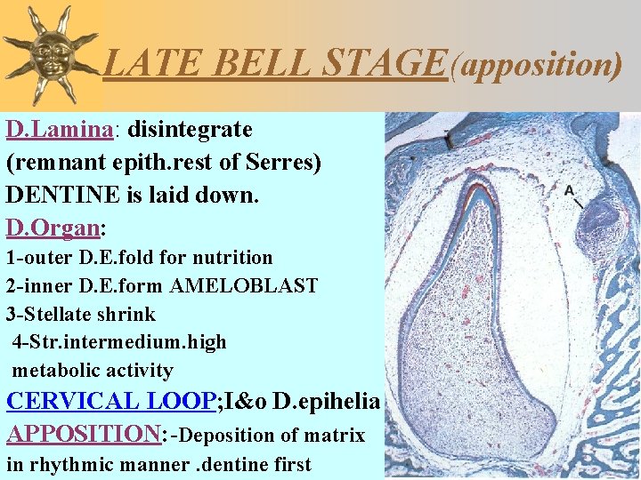 LATE BELL STAGE(apposition) D. Lamina: disintegrate (remnant epith. rest of Serres) DENTINE is laid