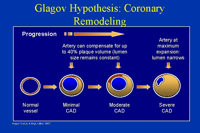 Glagov Hypothesis: Coronary Remodeling Progression Artery can compensate for up to 40% plaque volume