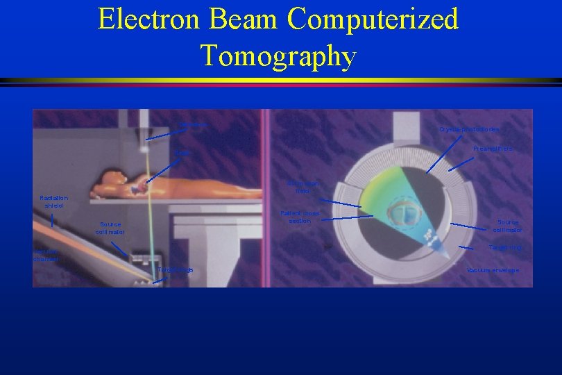 Electron Beam Computerized Tomography Detectors Crystal-photodiodes Preamplifiers Heart 47 cm scan field Radiation shield