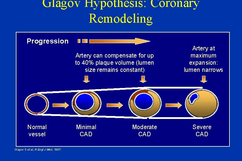 Glagov Hypothesis: Coronary Remodeling Progression Artery can compensate for up to 40% plaque volume