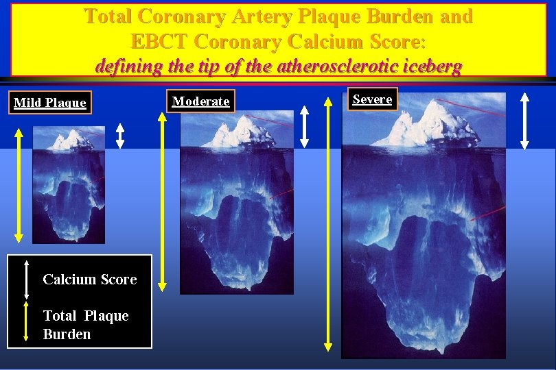 Total Coronary Artery Plaque Burden and EBCT Coronary Calcium Score: defining the tip of